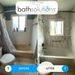 imgi_198_Before++After+FSBS+(3)