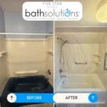 imgi_213_Before++After+FSBS+(1)