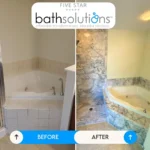 imgi_233_Before++After+FSBS+(5)